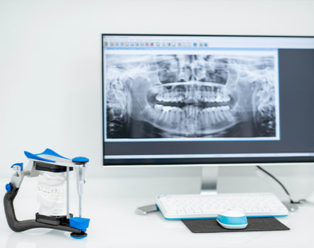 Dental Technology | iDental | Okotoks Dentist